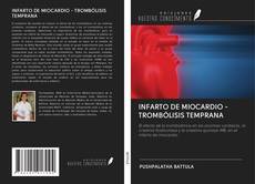 Bookcover of INFARTO DE MIOCARDIO - TROMBÓLISIS TEMPRANA