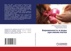 Copertina di Беременность и роды при миоме матки