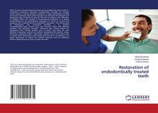 Bookcover of Restoration of endodontically treated teeth