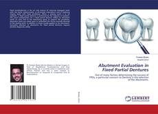 Copertina di Abutment Evaluation in Fixed Partial Dentures