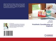 Copertina di Prosthetic Consideration of Implants
