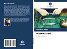 Buchcover von Prostatakrebs