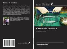 Capa do livro de Cancer de prostata 