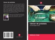 Copertina di Câncer de próstata