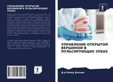 Bookcover of УПРАВЛЕНИЕ ОТКРЫТОЙ ВЕРШИНОЙ В ПУЛЬСИРУЮЩИХ ЗУБАХ