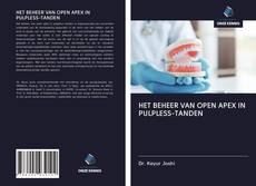 Copertina di HET BEHEER VAN OPEN APEX IN PULPLESS-TANDEN