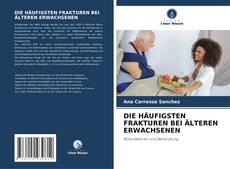 Buchcover von DIE HÄUFIGSTEN FRAKTUREN BEI ÄLTEREN ERWACHSENEN