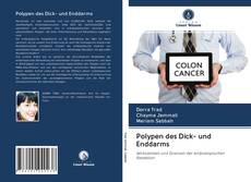 Buchcover von Polypen des Dick- und Enddarms