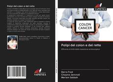 Bookcover of Polipi del colon e del retto