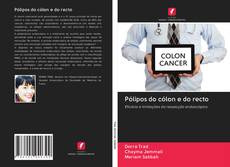 Buchcover von Pólipos do cólon e do recto
