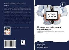 Capa do livro de Полипы толстой кишки и прямой кишки 