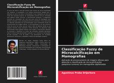 Copertina di Classificação Fuzzy de Microcalcificação em Mamografias