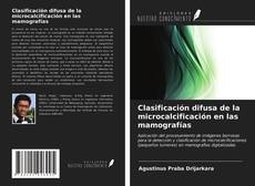 Обложка Clasificación difusa de la microcalcificación en las mamografías