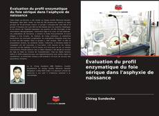 Buchcover von Évaluation du profil enzymatique du foie sérique dans l'asphyxie de naissance