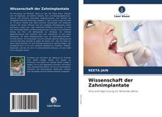 Wissenschaft der Zahnimplantate的封面