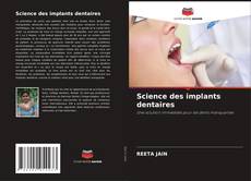Bookcover of Science des implants dentaires