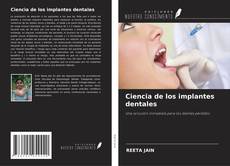 Portada del libro de Ciencia de los implantes dentales