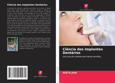 Ciência dos Implantes Dentários的封面
