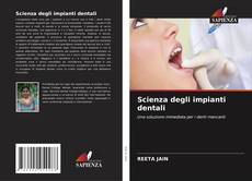 Обложка Scienza degli impianti dentali