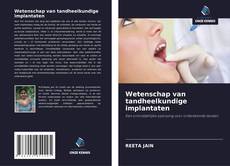 Wetenschap van tandheelkundige implantaten kitap kapağı
