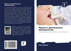 Buchcover von Наука о дентальных имплантатах