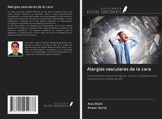 Bookcover of Alergias vasculares de la cara