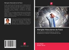 Bookcover of Alergias Vasculares da Face