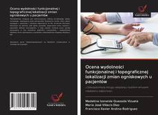 Portada del libro de Ocena wydolności funkcjonalnej i topograficznej lokalizacji zmian ogniskowych u pacjentów