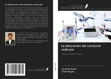 Bookcover of La obturación del conducto radicular