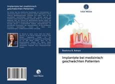 Implantate bei medizinisch geschwächten Patienten kitap kapağı