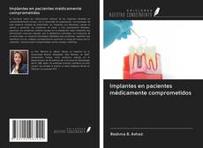 Bookcover of Implantes en pacientes médicamente comprometidos