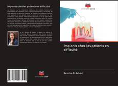 Bookcover of Implants chez les patients en difficulté