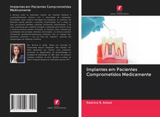 Implantes em Pacientes Comprometidos Medicamente kitap kapağı
