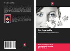 Copertina di Genioplastia