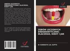 ZĘBÓW LECZONYCH ENDODONTYCZNIE: DLACZEGO, KIEDY I JAK的封面