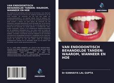 Copertina di VAN ENDODONTISCH BEHANDELDE TANDEN: WAAROM, WANNEER EN HOE