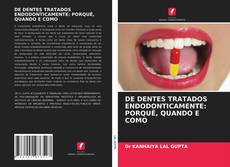 DE DENTES TRATADOS ENDODONTICAMENTE: PORQUÊ, QUANDO E COMO的封面