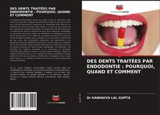 Bookcover of DES DENTS TRAITÉES PAR ENDODONTIE : POURQUOI, QUAND ET COMMENT