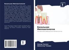 Capa do livro de Базальная Имплантология 