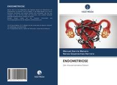 Bookcover of ENDOMETRIOSE