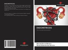 Bookcover of ENDOMETRIOSIS