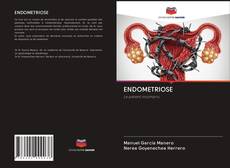 Bookcover of ENDOMETRIOSE