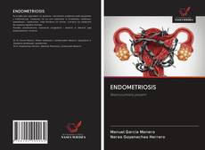 Buchcover von ENDOMETRIOSIS