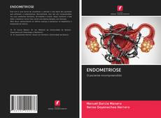 Buchcover von ENDOMETRIOSE