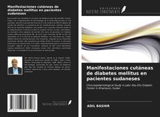 Couverture de Manifestaciones cutáneas de diabetes mellitus en pacientes sudaneses