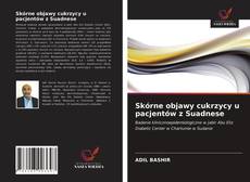 Bookcover of Skórne objawy cukrzycy u pacjentów z Suadnese