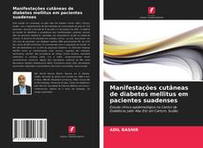 Capa do livro de Manifestações cutâneas de diabetes mellitus em pacientes suadenses 