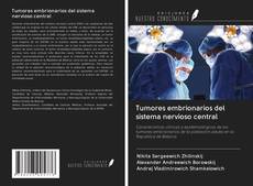 Bookcover of Tumores embrionarios del sistema nervioso central