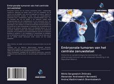 Buchcover von Embryonale tumoren van het centrale zenuwstelsel