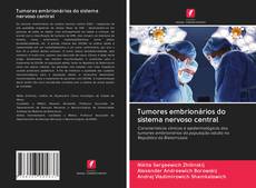 Buchcover von Tumores embrionários do sistema nervoso central